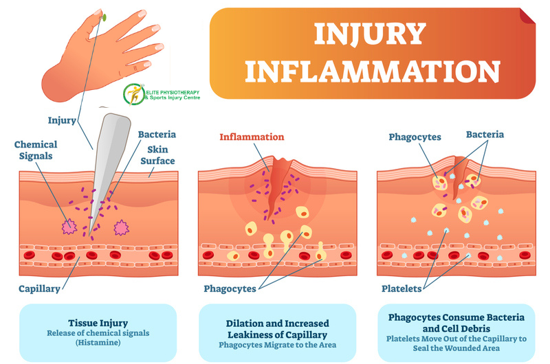 Inflammation