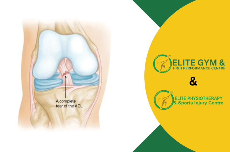 ACL Injuries: Its Best Physiotherapy Treatment