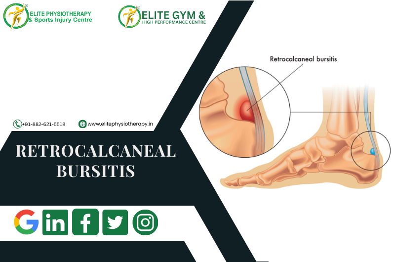 Retrocalcaneal Bursitis