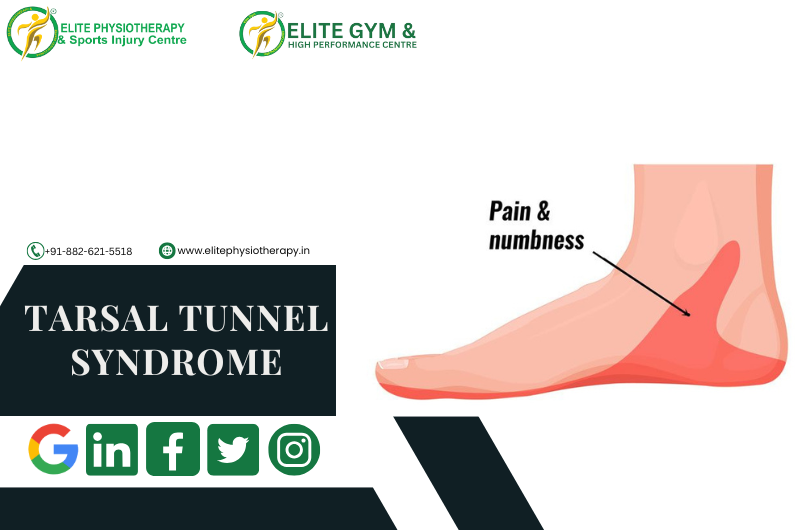 TARSAL TUNNEL SYNDROME