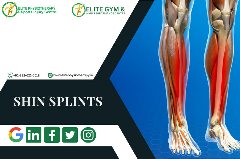 SHIN SPLINTS OR MEDIAL TIBIAL STRESS SYNDROME